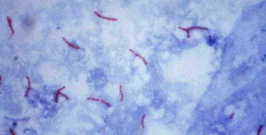 La epidemia de tuberculosis en China se deriva de la expansión de cuatro cepas de bacterias hace mil años