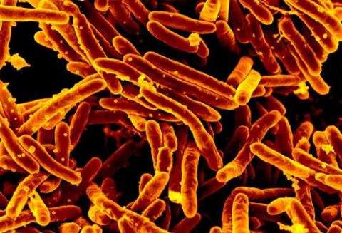 Estudio identifica mutación genética responsable de vulnerabilidad a tuberculosis