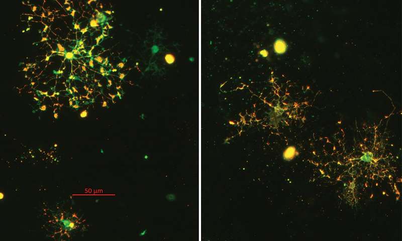 Los hallazgos del cultivo celular in vitro podrían conducir a nuevas intervenciones para la esquizofrenia
