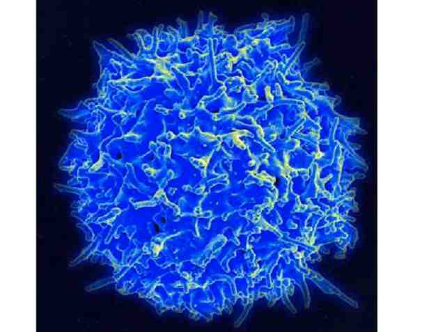 Se revela la naturaleza de las células inmunes en el cerebro humano