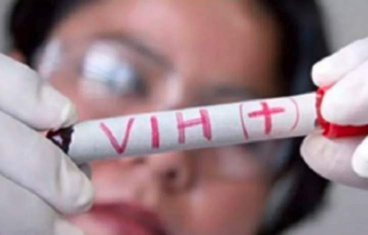 Un estudio francés abre una puerta para acabar con el VIH