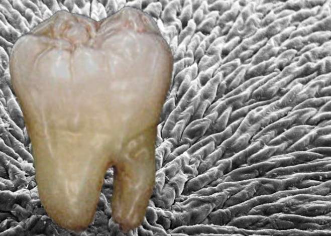 Desarrollan material que regenera el esmalte dental