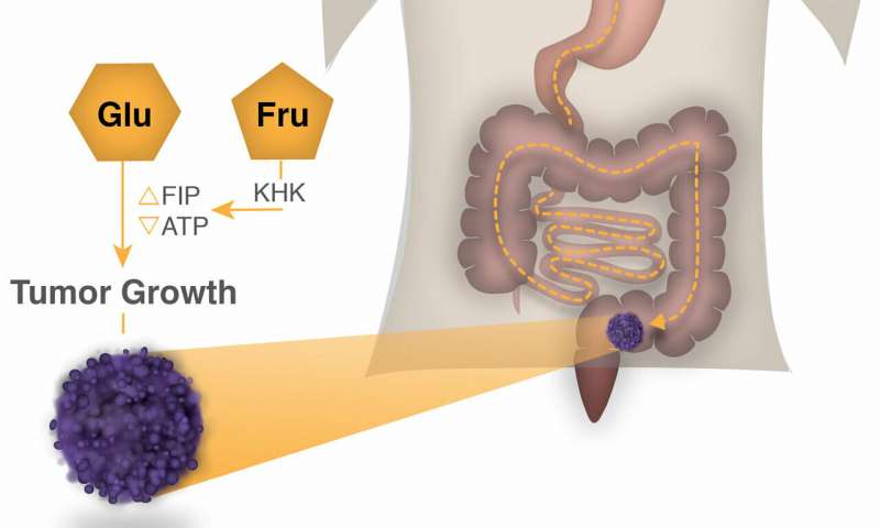 El jarabe de maíz rico en fructosa estimula el crecimiento de tumores intestinales en ratones