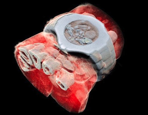 Nuevo ecógrafo toma rayos X en 3D, a color y cuyo fin busca evitar operaciones quirúrgicas