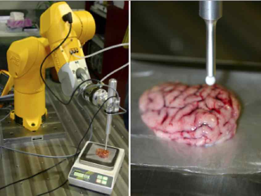 Un bisturí inteligente que detecta tumores cerebrales
