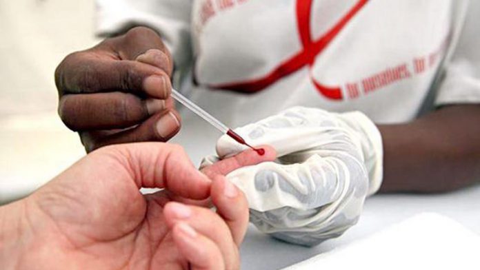 Según experto: Estamos cerca de erradicar el VIH pero lejos de hallar su cura