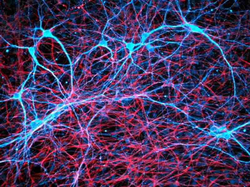 Las células cancerosas tienen la capacidad «inquietante» de secuestrar los nervios del cerebro.