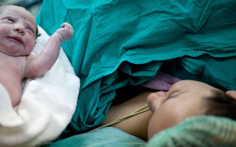 A los bebés de cesárea les faltan microbios clave