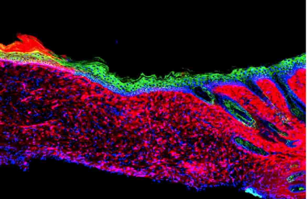 Los científicos logran por primera vez regenerar ‘in vivo’ la piel de un mamífero