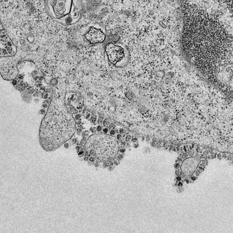 El último coronavirus: las muertes en China superan el peaje del SARS