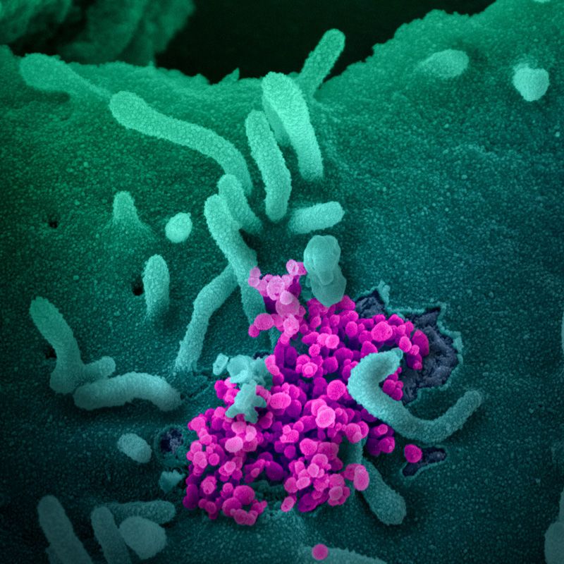 Coronavirus más reciente: primera infección detectada en África