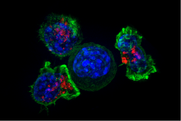 Los científicos descubren las funciones de un motor celular en el cáncer