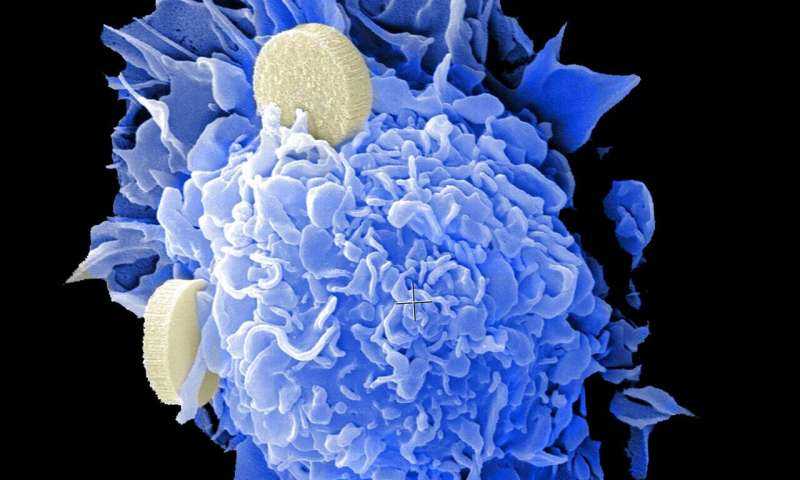 Nuevo fármaco genético objetivo para el cáncer colorrectal resistente al tratamiento