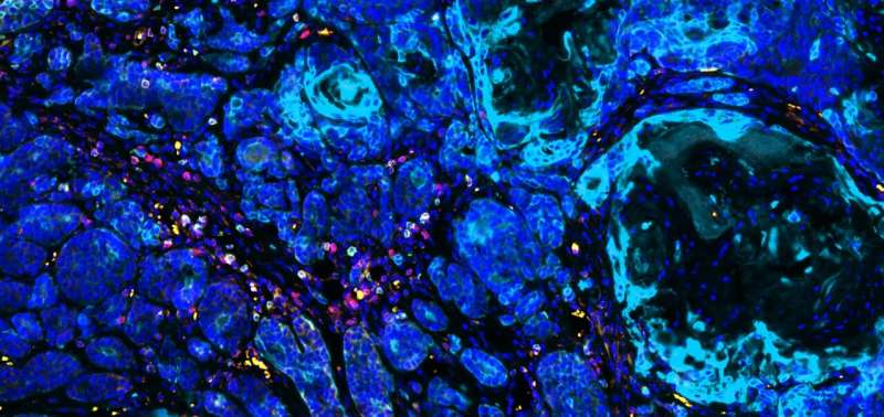 Las células expuestas a carcinógenos proporcionan pistas para combatir los cánceres resistentes al tratamiento