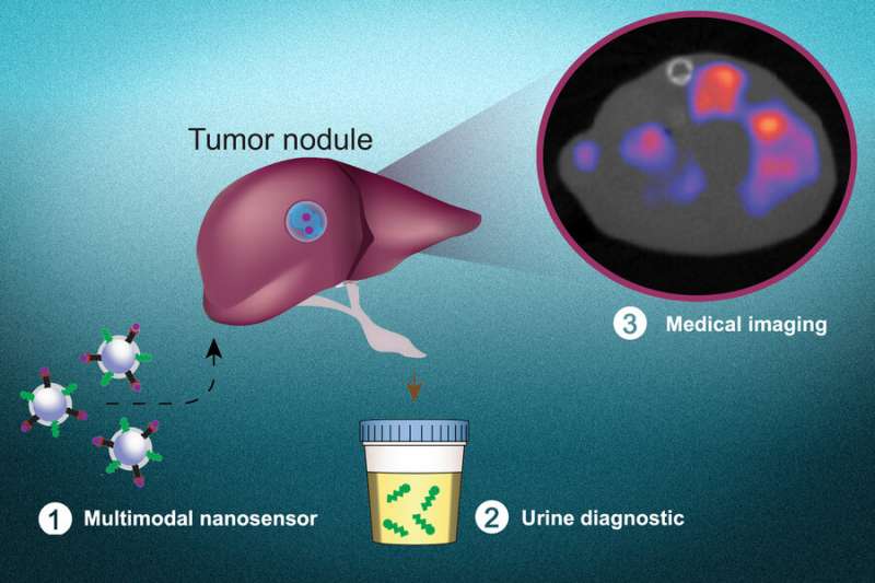 Una prueba no invasiva para detectar células cancerosas y determinar su ubicación