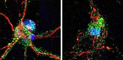 Los investigadores identifican la proteína cerebral crucial para la recuperación de un accidente cerebrovascular