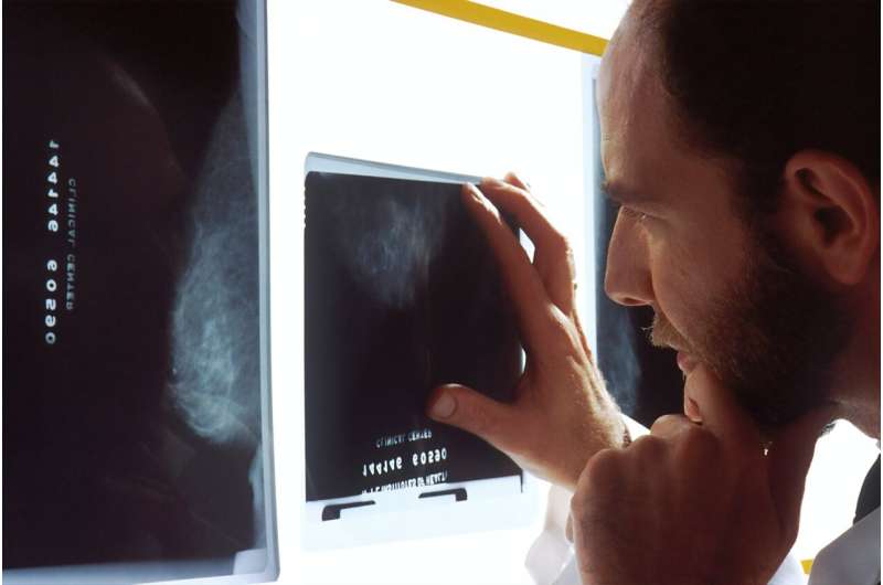 Cómo una nueva herramienta de diagnóstico por imágenes ayuda a estadificar mejor a los hombres con cáncer de próstata