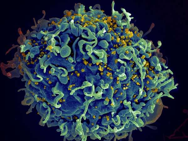 Pacientes con VIH ‘curados’ por su propia biología única pueden albergar secretos para acabar con el flagelo mundial