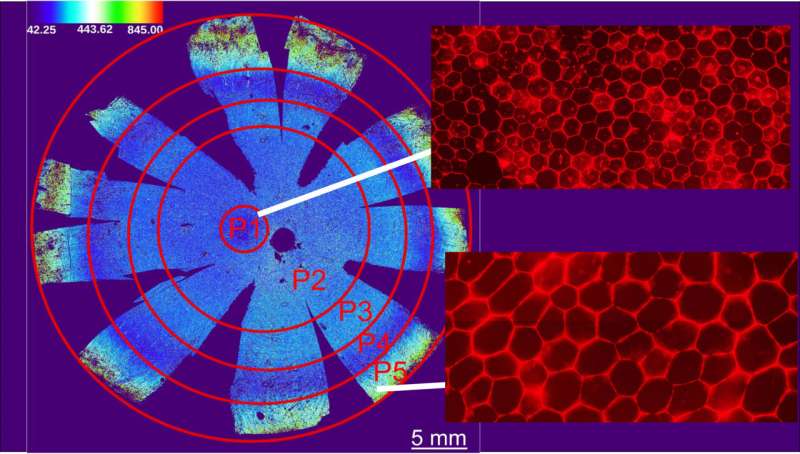 El mapa de células de la retina podría avanzar en terapias precisas para enfermedades que causan ceguera