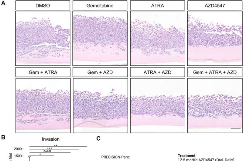 Investigación identifica una nueva forma de detener la invasión del cáncer de páncreas dirigiéndose a las células sanas