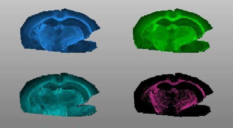 Los científicos descubren moléculas antiinflamatorias que disminuyen en el cerebro que envejece