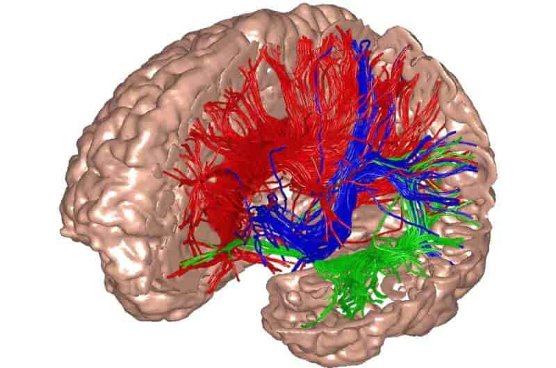 Se descubrió que la ketamina aumenta el ruido cerebral