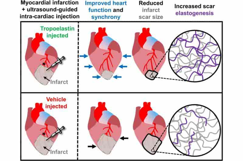 Los científicos encuentran la manera de curar las cicatrices dejadas por los ataques al corazón