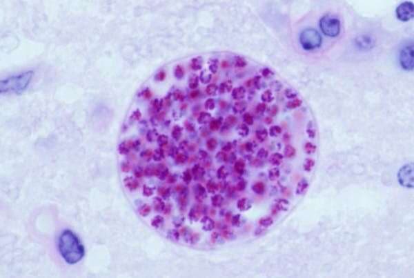 Toxoplasma: el parásito que se apodera de nuestro cerebro