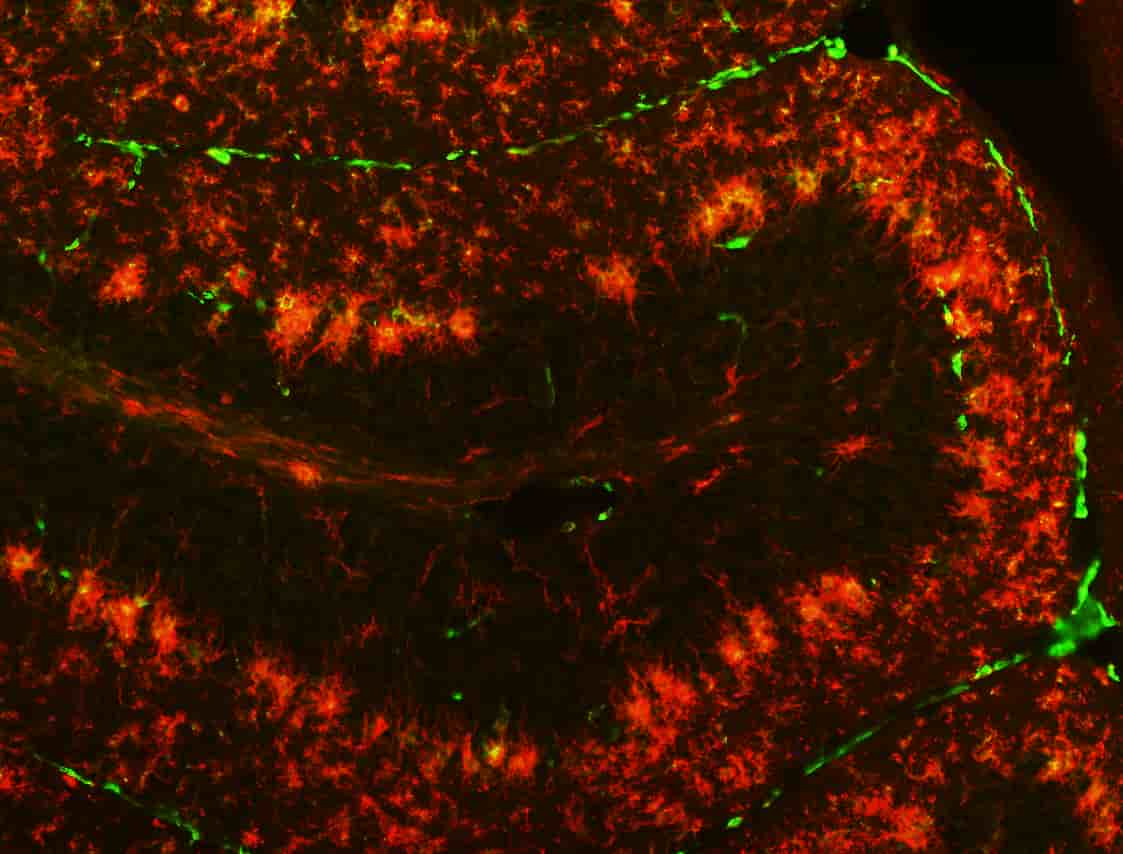 Un estudio logra avances para tratar la inflamación del sistema nervioso en enfermedades neurodegenerativas