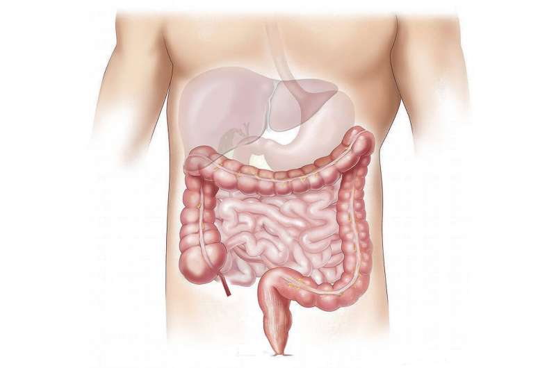 La clave para prevenir la progresión del VIH puede estar en el intestino