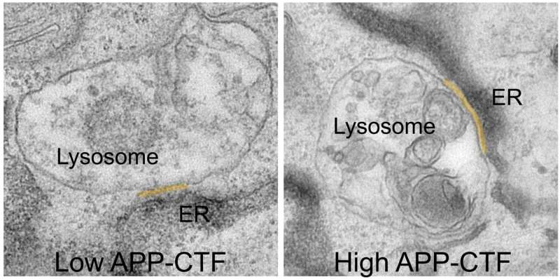 Nuevo mecanismo descubierto en las primeras etapas de la enfermedad de Alzheimer