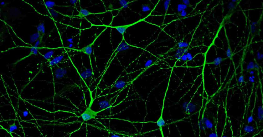 Un protocolo innovador revela la distribución de un receptor clave para la memoria en cerebros con alzhéimer