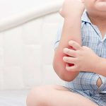 Los niños con obesidad tienen mayores tasas de enfermedades dermatológicas