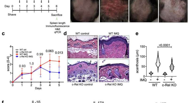 Identifican proteína clave que intensifica la psoriasis