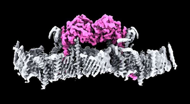 Los científicos resuelven un misterio que ha durado décadas sobre el Parkinson