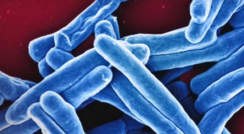 A medida que aumentan los casos de tuberculosis en Estados Unidos y en todo el mundo, los funcionarios de salud se preguntan por el resurgimiento