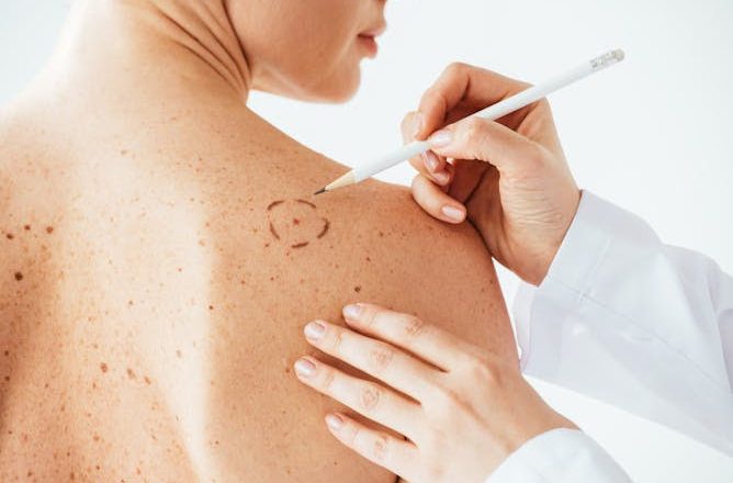 Llegan las vacunas contra el melanoma: ¿cómo funcionan?