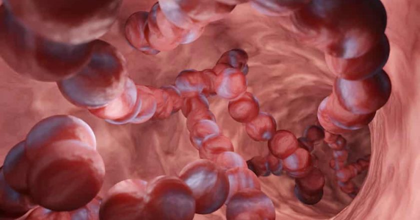 Una bacteria letal común se propaga en EEUU: expertos alertan sobre una pandemia silenciosa