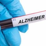 Alzheimer en 2025: qué hay realmente de nuevo (diagnóstico, fármacos y prevención)