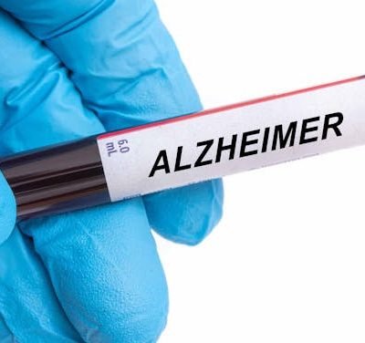El papel de los ácidos grasos omega-3 en la protección de las mujeres frente al Alzheimer: nuevos hallazgos 2025