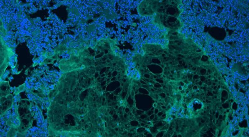 Mejor que los puntos: investigadores desarrollan un parche biocompatible para lesiones de órganos blandos