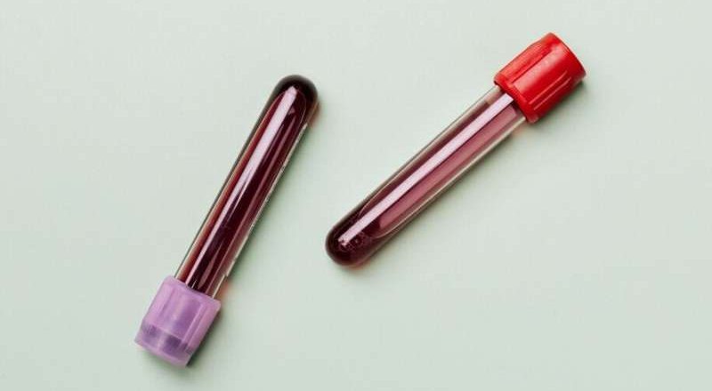 EE.UU. aprueba el primer análisis de sangre para el Alzheimer