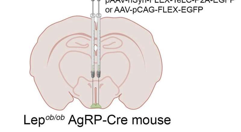 ¿Es posible apuntar al cerebro para tratar la diabetes tipo 2?