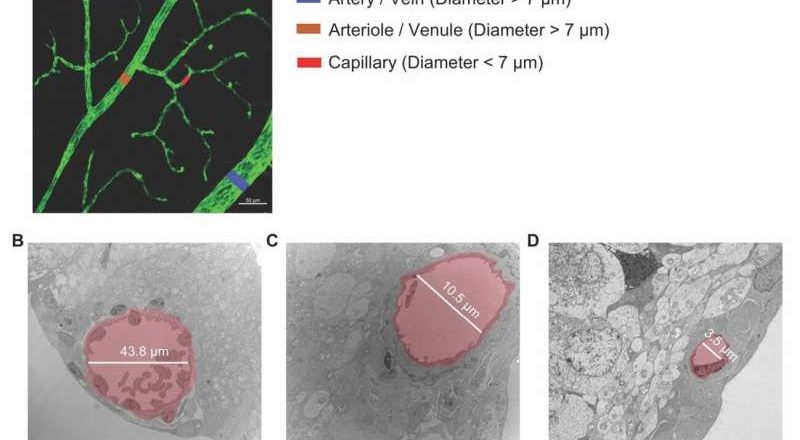 Un fármaco experimental bloquea la proteína que vincula el bajo nivel de azúcar en sangre con la pérdida de visión diabética
