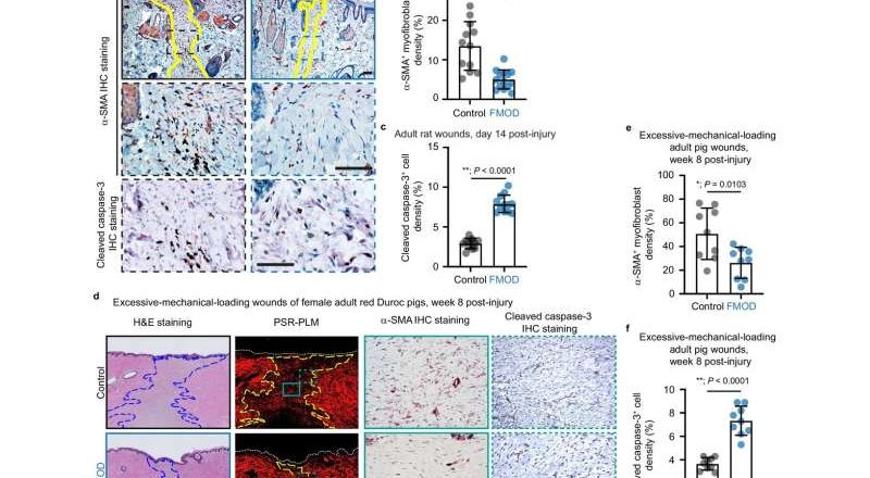 Una proteína recientemente identificada podría mitigar o eliminar la cicatrización excesiva durante la curación de heridas.