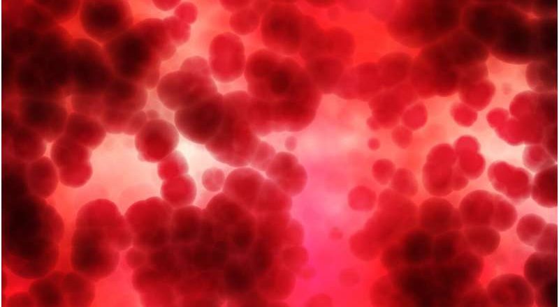 Un fármaco de inmunoterapia mejora los resultados del cáncer de sangre de alto riesgo en un ensayo clínico