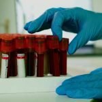 Una simple prueba de resistencia a la insulina también podría predecir el deterioro cognitivo en pacientes con Alzheimer