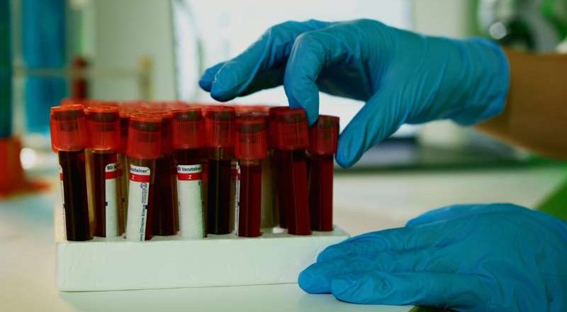 Una simple prueba de resistencia a la insulina también podría predecir el deterioro cognitivo en pacientes con Alzheimer