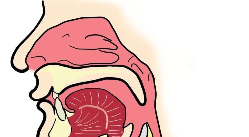 Investigador utiliza herramienta de IA para diagnosticar cánceres de garganta a través de la voz humana