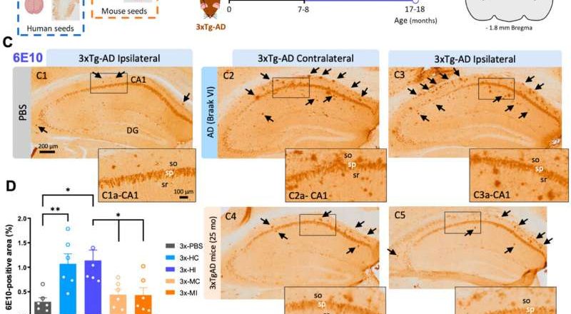 La investigación sobre la enfermedad de Alzheimer ofrece esperanza para encontrar un objetivo terapéutico que detenga la progresión